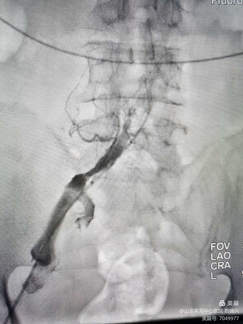 腿腫莫忘了他5.jpg 腿腫莫忘了他5.jpg
