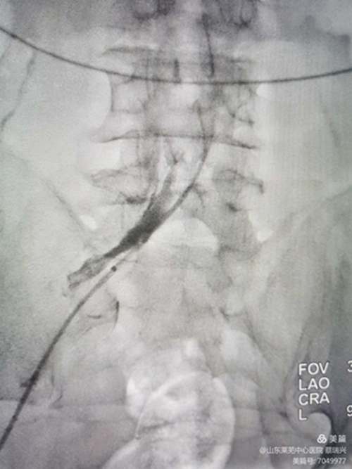 腿腫莫忘了他6.jpg 腿腫莫忘了他6.jpg