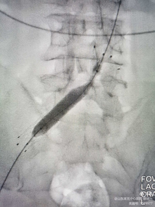 腿腫莫忘了他7.jpg 腿腫莫忘了他7.jpg