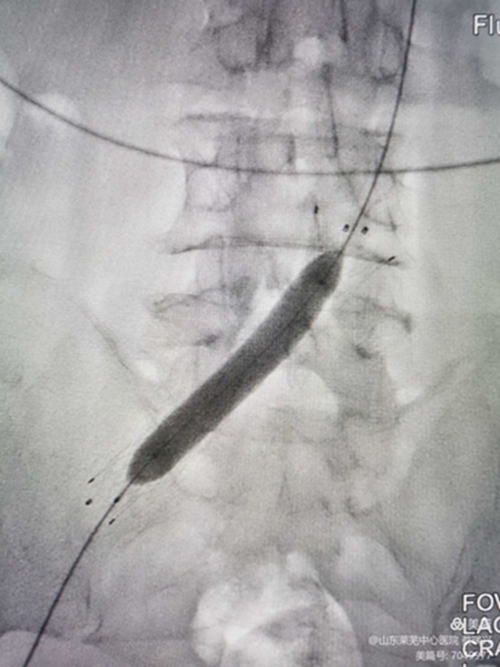 腿腫莫忘了他8.jpg 腿腫莫忘了他8.jpg