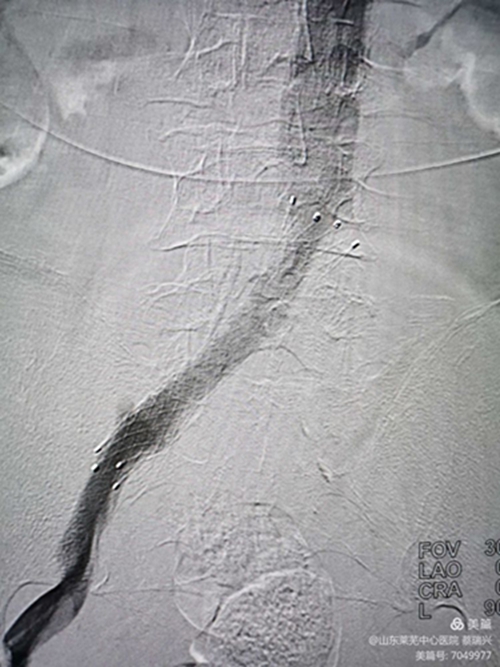 腿腫莫忘了他9.jpg 腿腫莫忘了他9.jpg