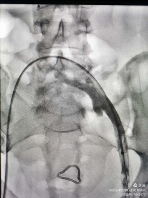 腿腫莫忘了他10.jpg 腿腫莫忘了他10.jpg