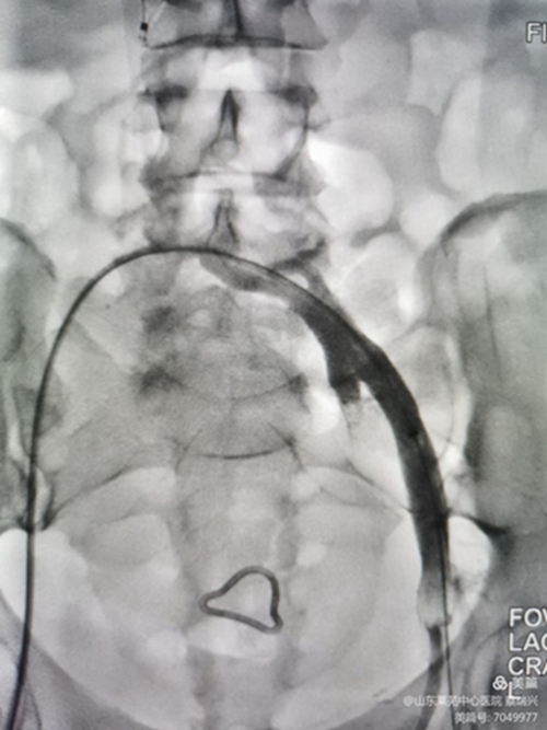 腿腫莫忘了他11.jpg 腿腫莫忘了他11.jpg