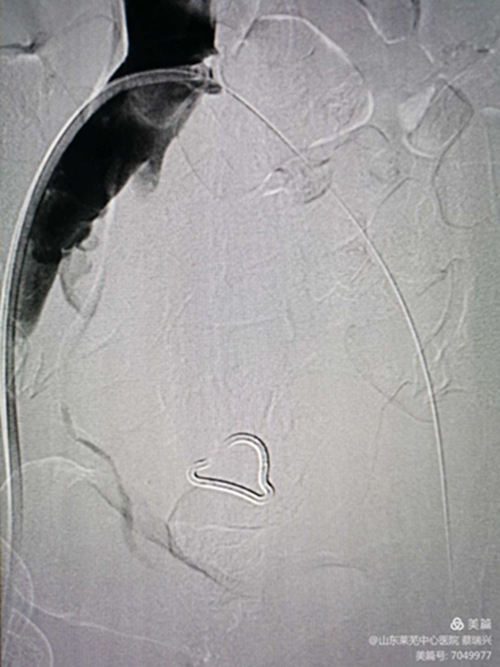 腿腫莫忘了他12.jpg 腿腫莫忘了他12.jpg