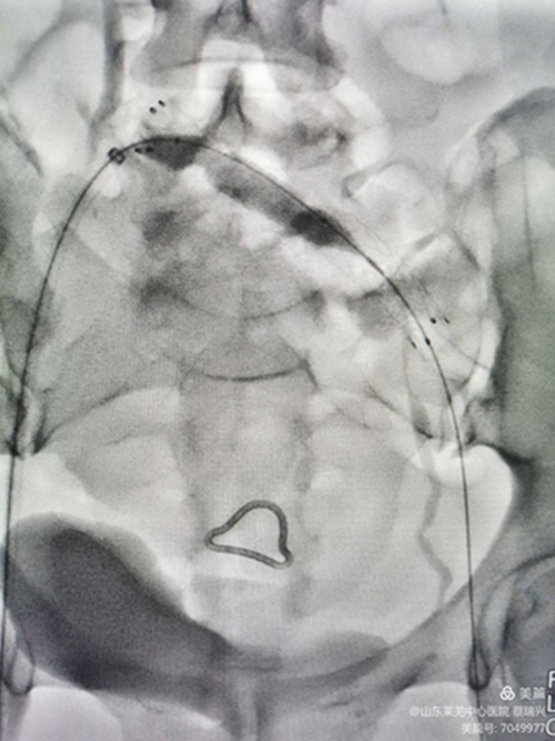 腿腫莫忘了他13.jpg 腿腫莫忘了他13.jpg
