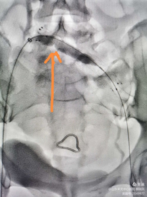 腿腫莫忘了他14.jpg 腿腫莫忘了他14.jpg