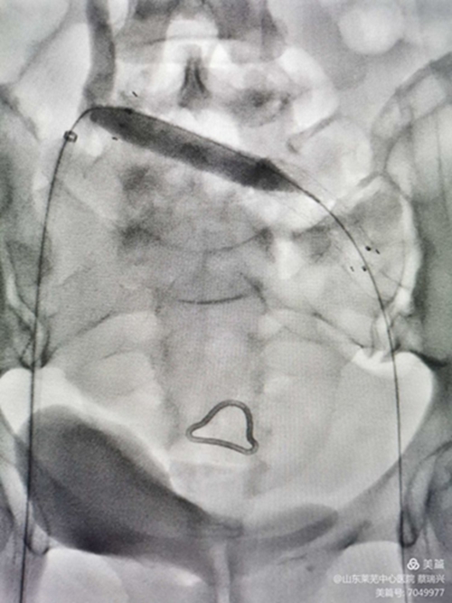 腿腫莫忘了他15.jpg 腿腫莫忘了他15.jpg