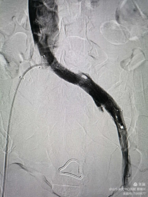 腿腫莫忘了他16.jpg 腿腫莫忘了他16.jpg